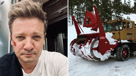 did jeremy renner lose his leg|Jeremy Renner Walking Again After Snow Plow Accident。